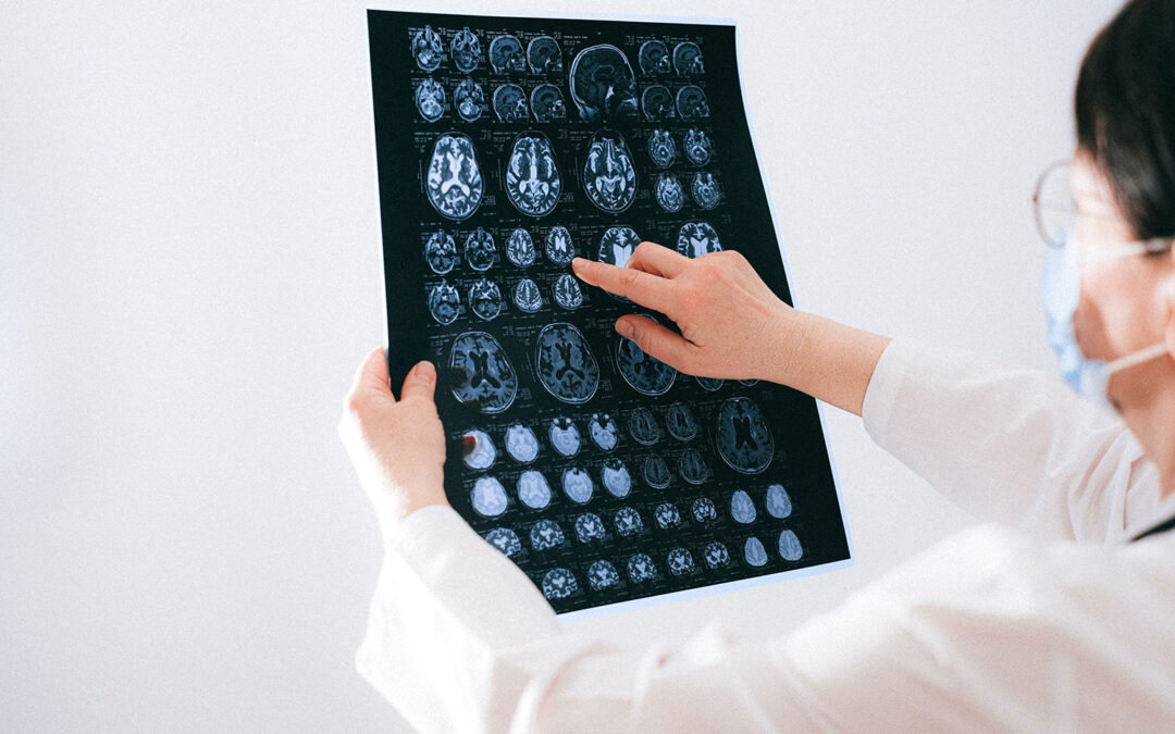 Why You Need A Brain Injury Attorney