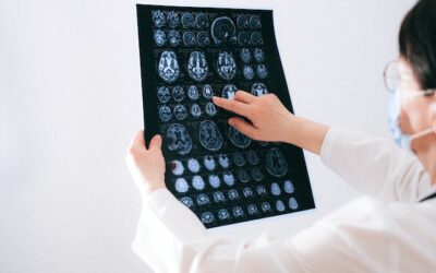 What is Considered a Serious Brain Injury?