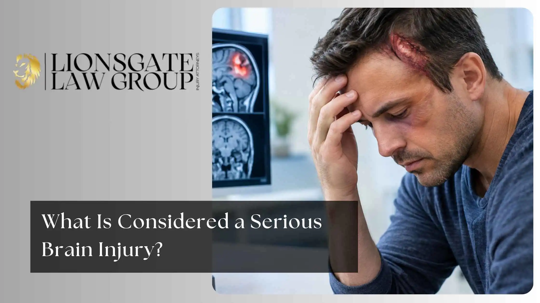 What Is Considered a Serious Brain Injury